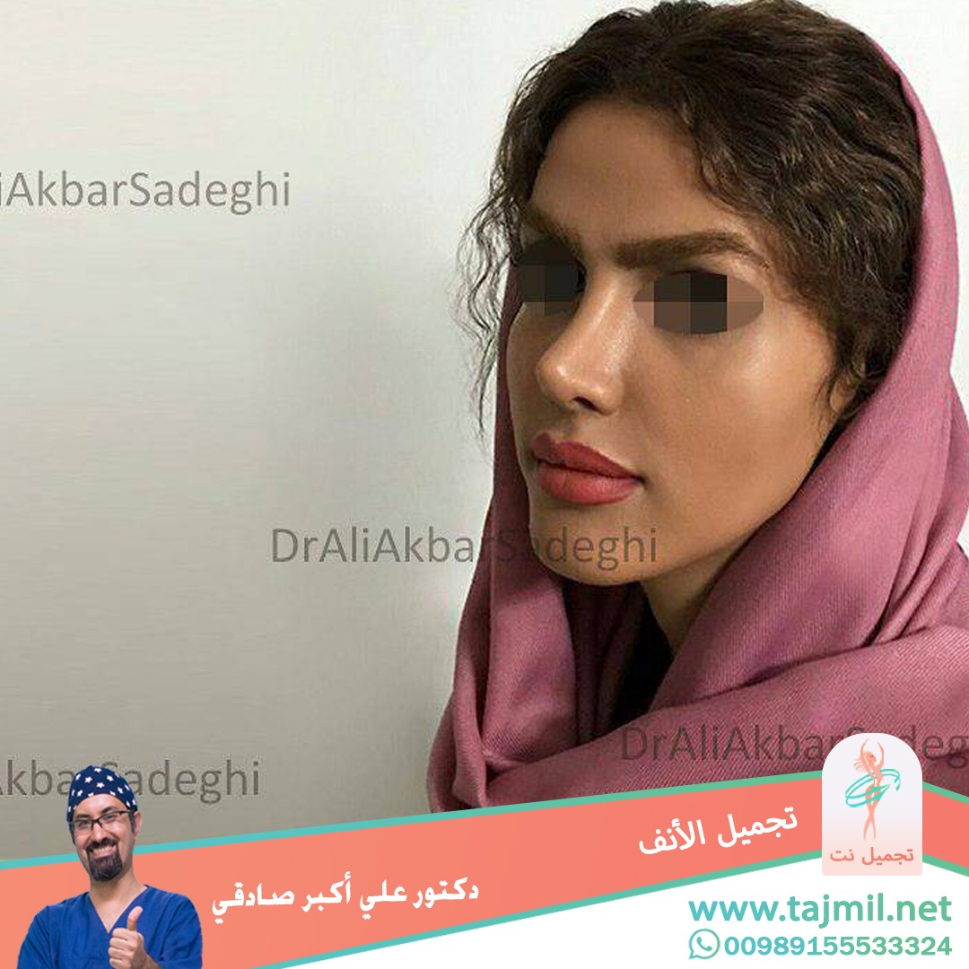  - دكتور علي أکبر صادقي عملية تجميل الانف في ايران مع تجميل نت