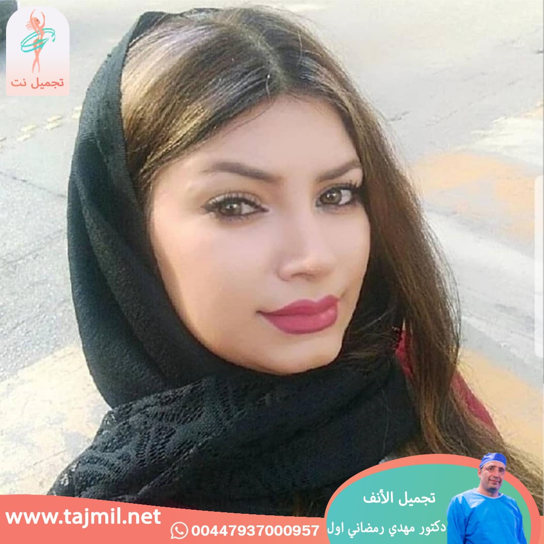  - دكتور مهدي رمضاني اول عملية تجميل الانف في ايران مع تجميل نت