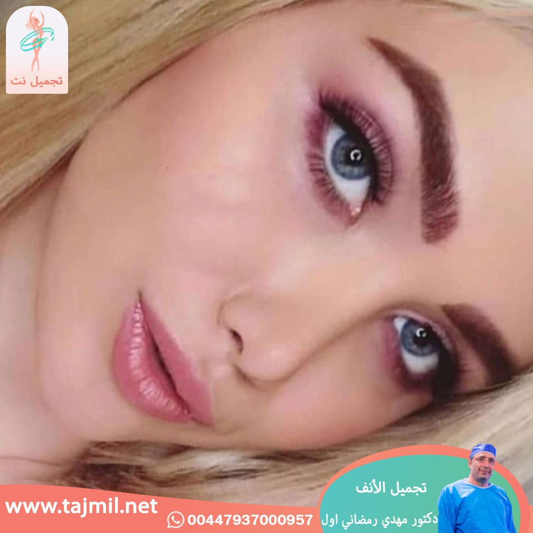  - دكتور مهدي رمضاني اول عملية تجميل الانف في ايران مع تجميل نت