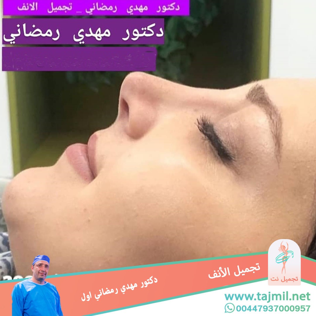  - دكتور مهدي رمضاني اول عملية تجميل الانف في ايران مع تجميل نت