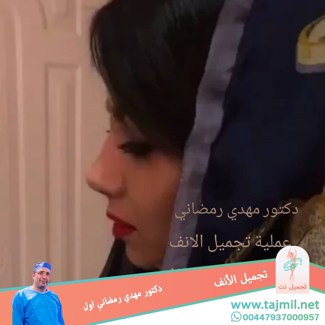  - دكتور مهدي رمضاني اول عملية تجميل الانف في ايران مع تجميل نت