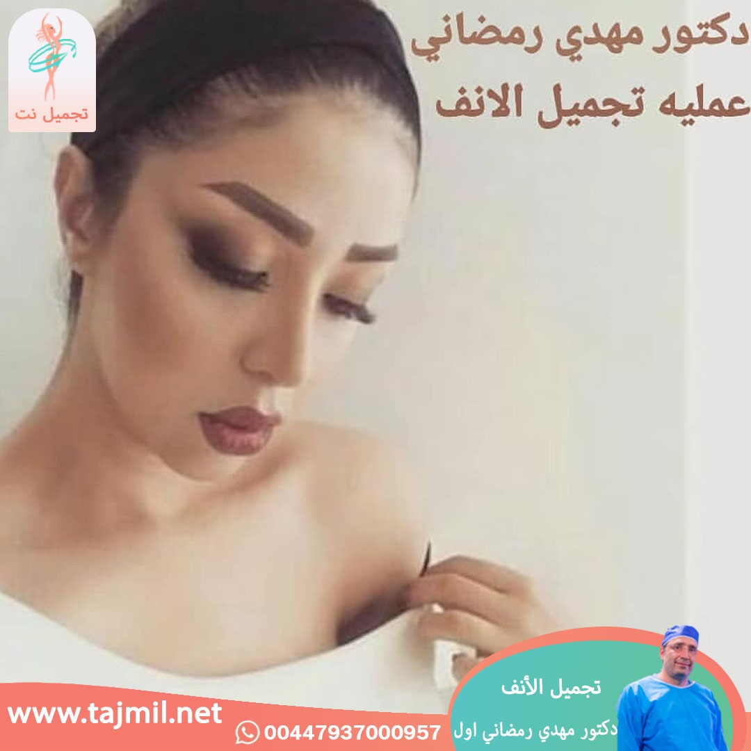  - دكتور مهدي رمضاني اول عملية تجميل الانف في ايران مع تجميل نت