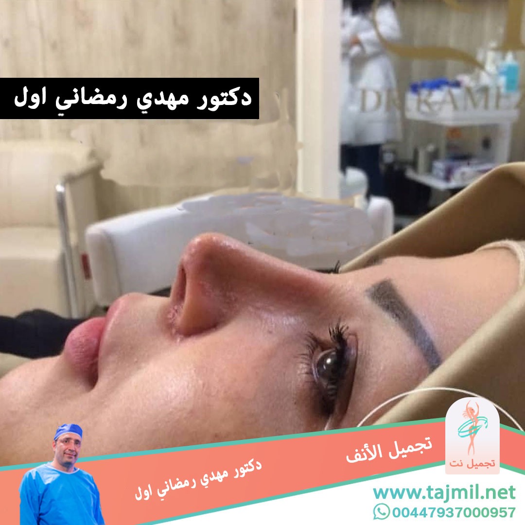  - دكتور مهدي رمضاني اول عملية تجميل الانف في ايران مع تجميل نت