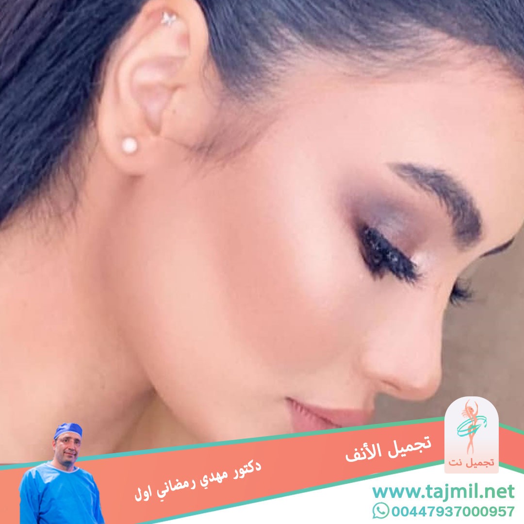  - دكتور مهدي رمضاني اول عملية تجميل الانف في ايران مع تجميل نت