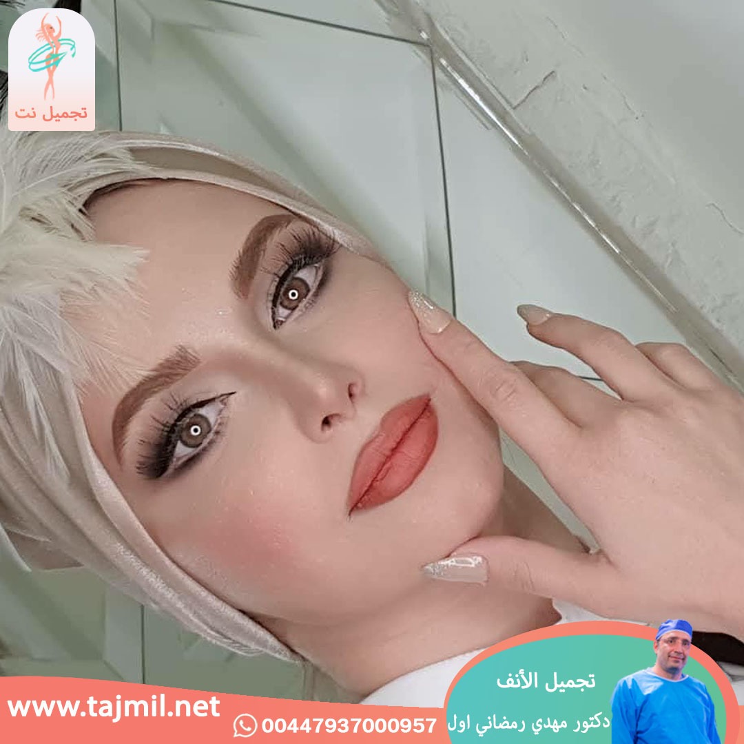  - دكتور مهدي رمضاني اول عملية تجميل الانف في ايران مع تجميل نت