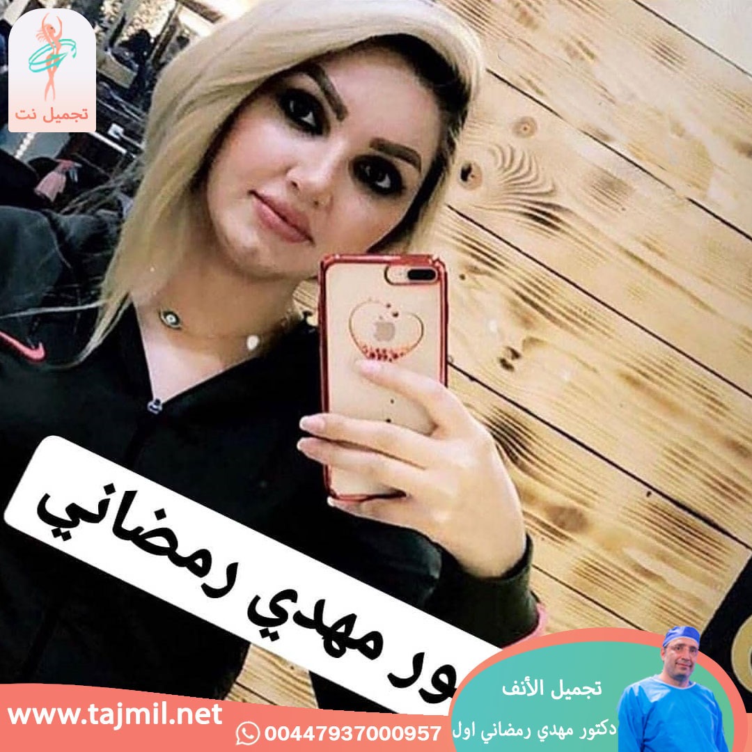  - دكتور مهدي رمضاني اول عملية تجميل الانف في ايران مع تجميل نت