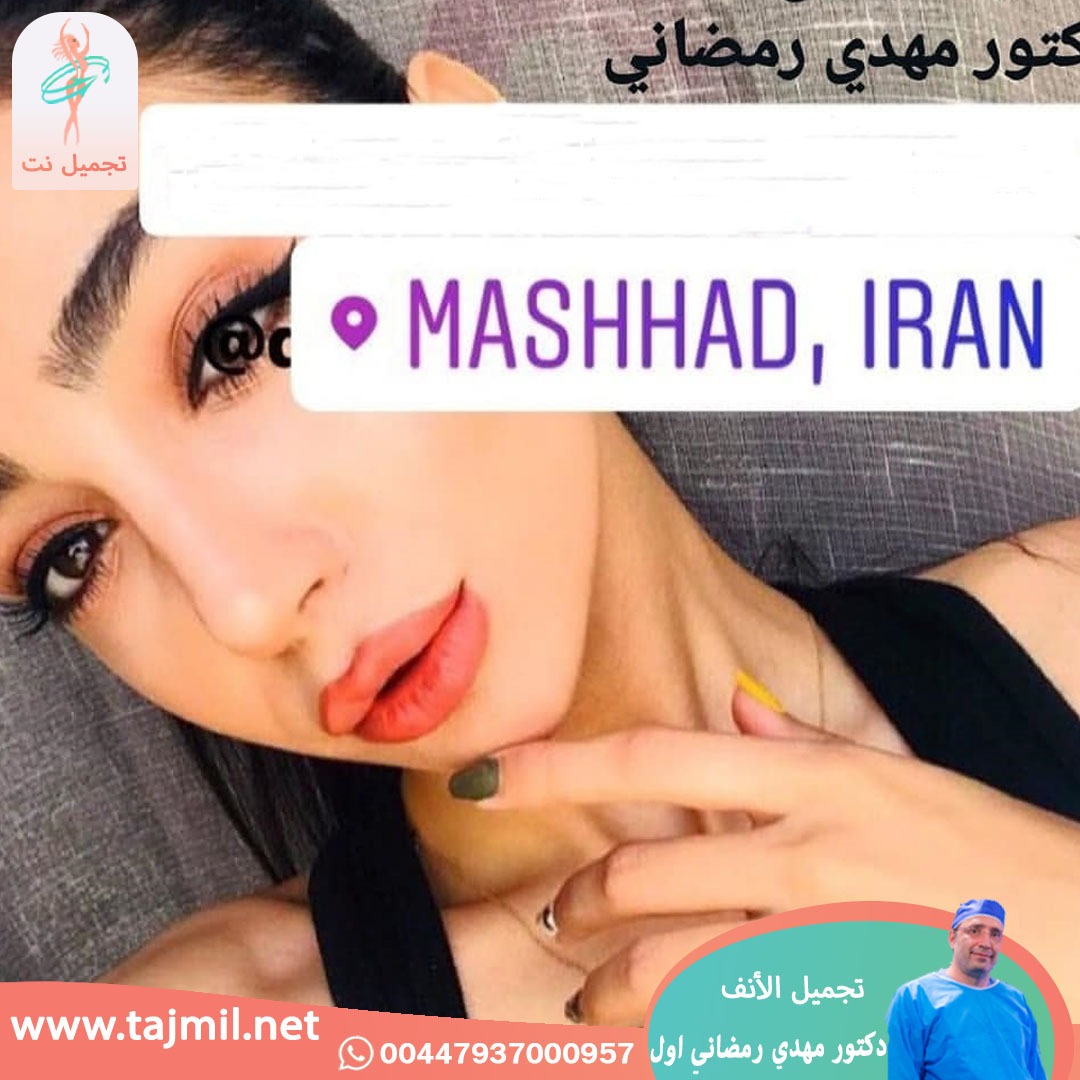  - دكتور مهدي رمضاني اول عملية تجميل الانف في ايران مع تجميل نت