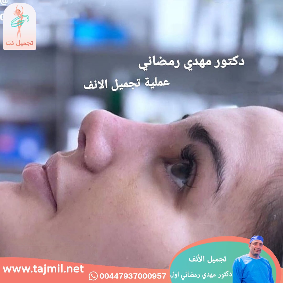  - دكتور مهدي رمضاني اول عملية تجميل الانف في ايران مع تجميل نت