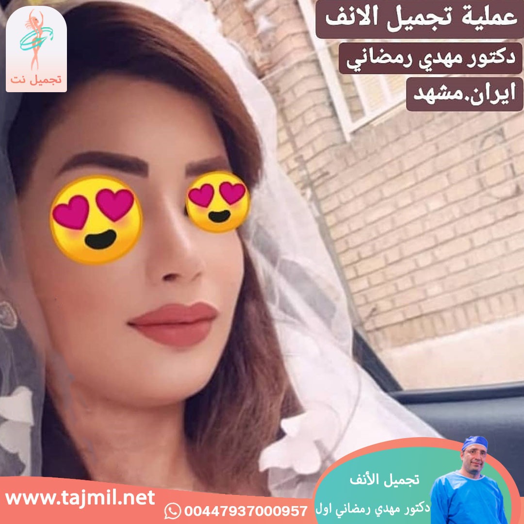  - دكتور مهدي رمضاني اول عملية تجميل الانف في ايران مع تجميل نت