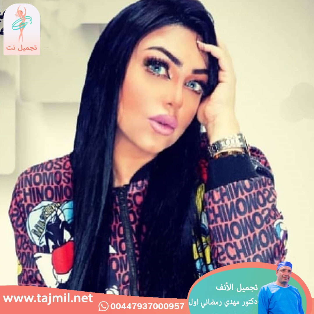  - دكتور مهدي رمضاني اول عملية تجميل الانف في ايران مع تجميل نت