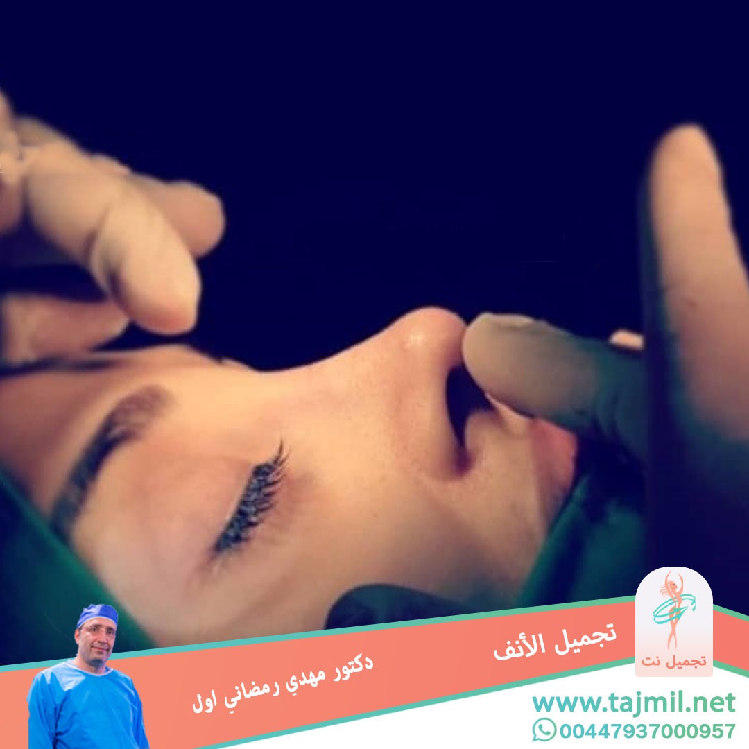  - دكتور مهدي رمضاني اول عملية تجميل الانف في ايران مع تجميل نت