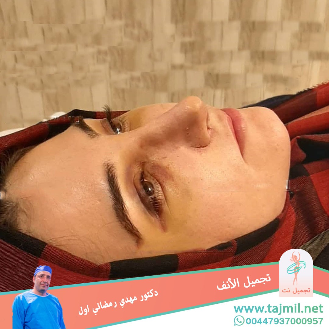  - دكتور مهدي رمضاني اول عملية تجميل الانف في ايران مع تجميل نتدكتور مهدي رمضاني اول عملية تجميل الانف في ايران مع تجميل نت