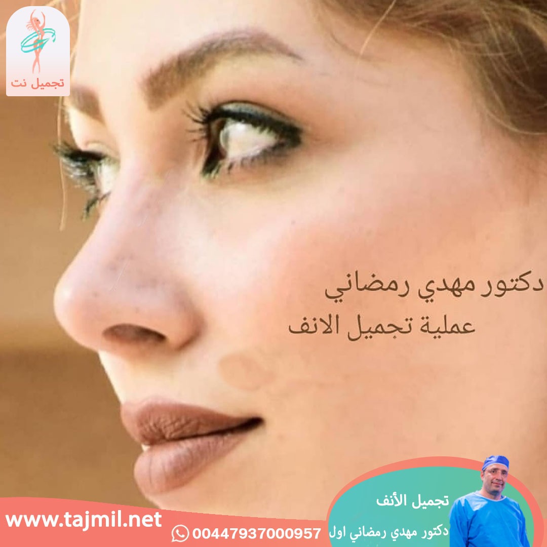  - دكتور مهدي رمضاني اول عملية تجميل الانف في ايران مع تجميل نت