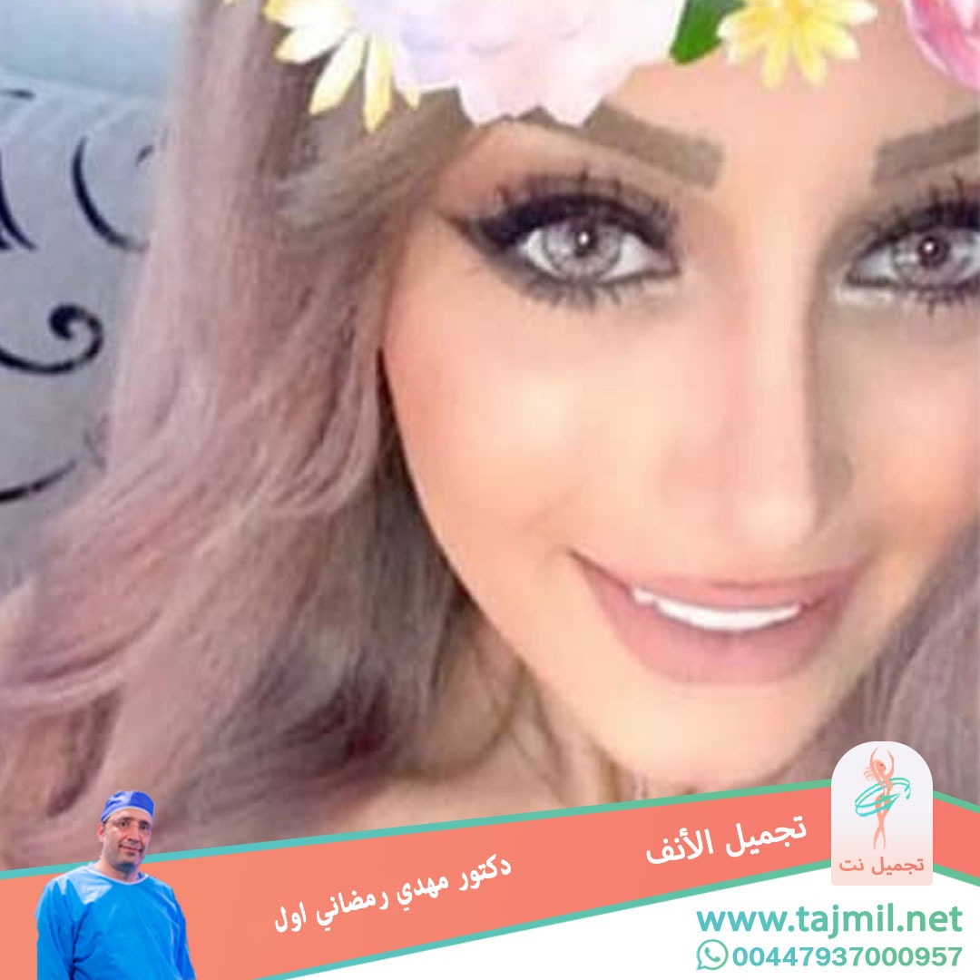  - دكتور مهدي رمضاني اول عملية تجميل الانف في ايران مع تجميل نت