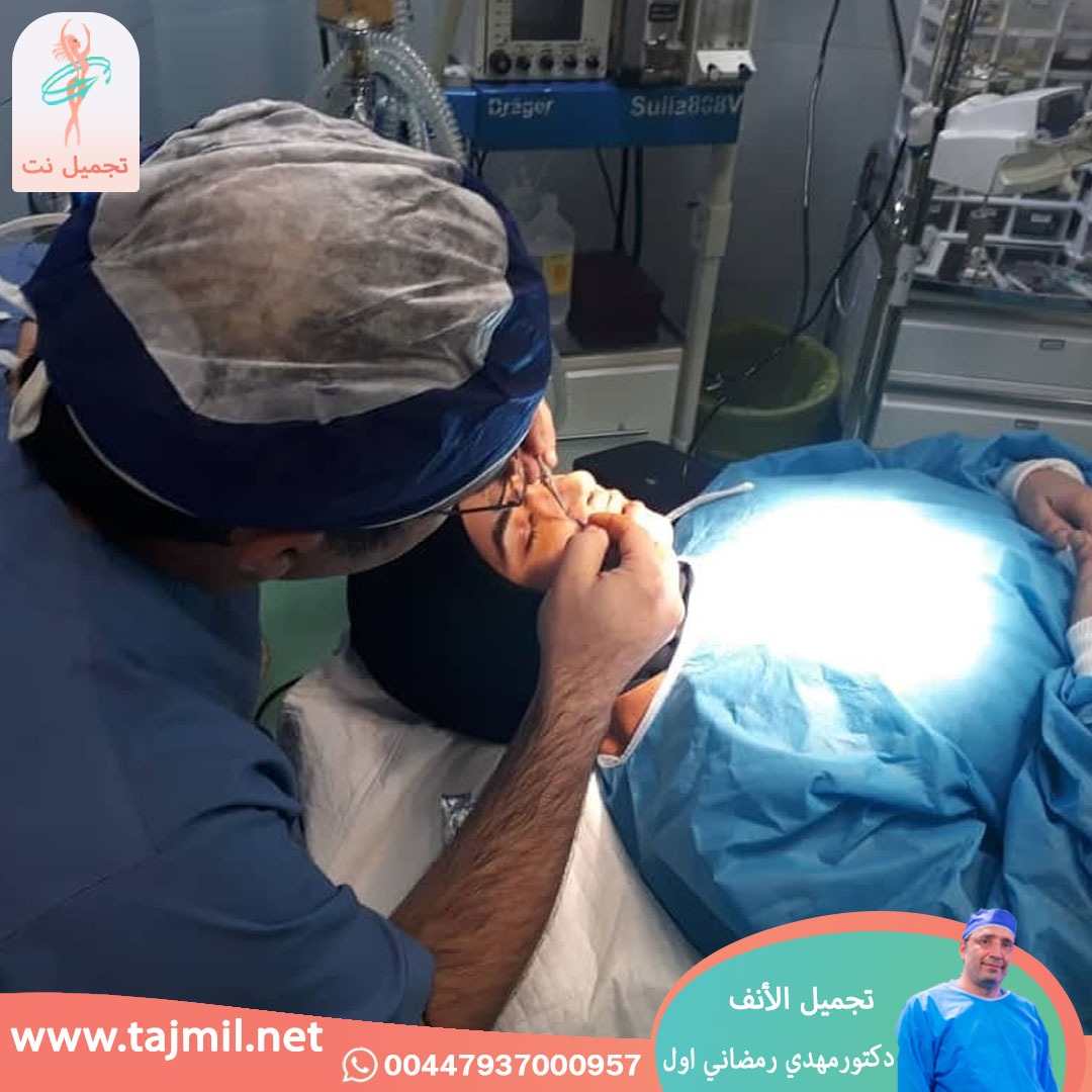  - دكتور مهدي رمضاني اول عملية تجميل الانف في ايران مع تجميل نت