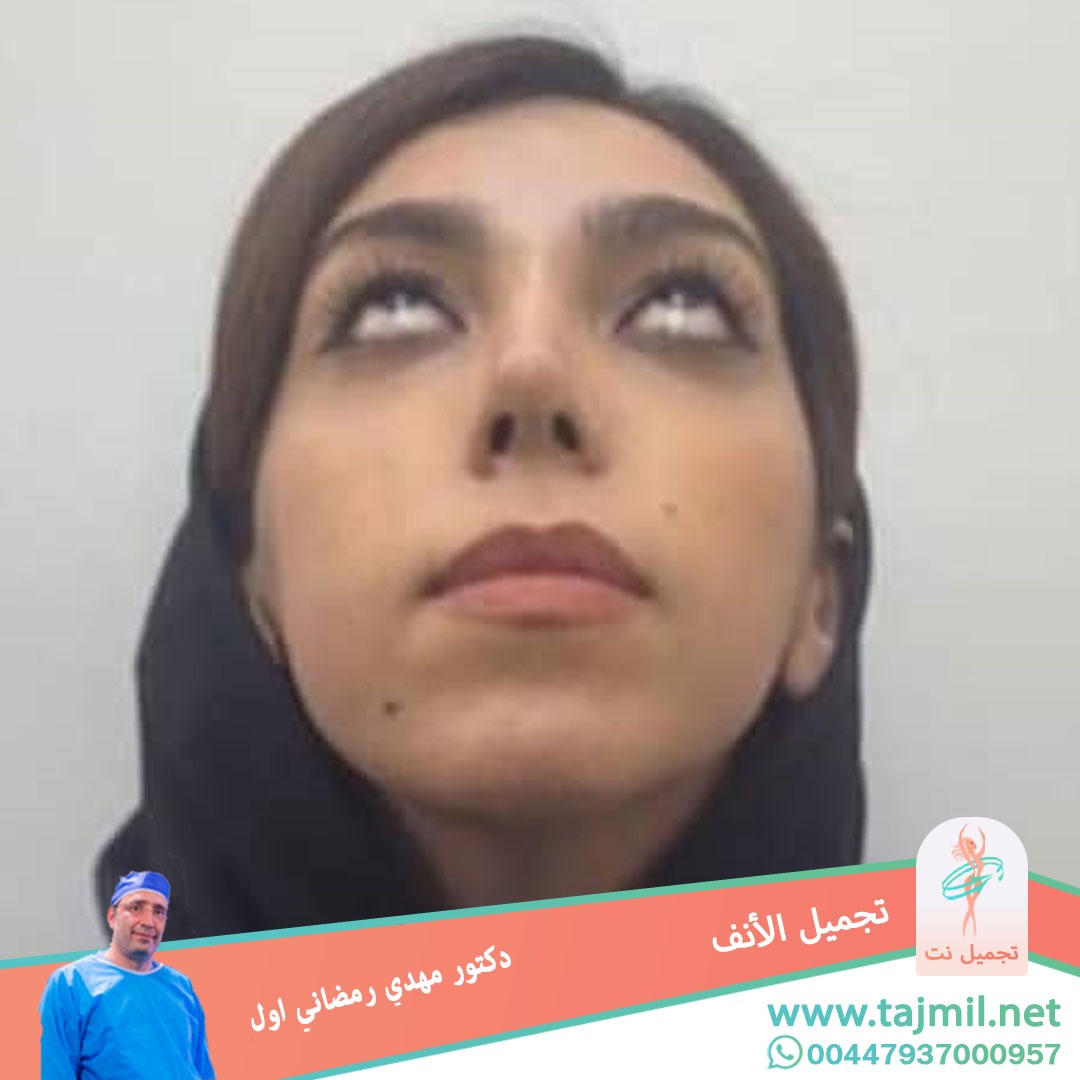  - دكتور مهدي رمضاني اول عملية تجميل الانف في ايران مع تجميل نت