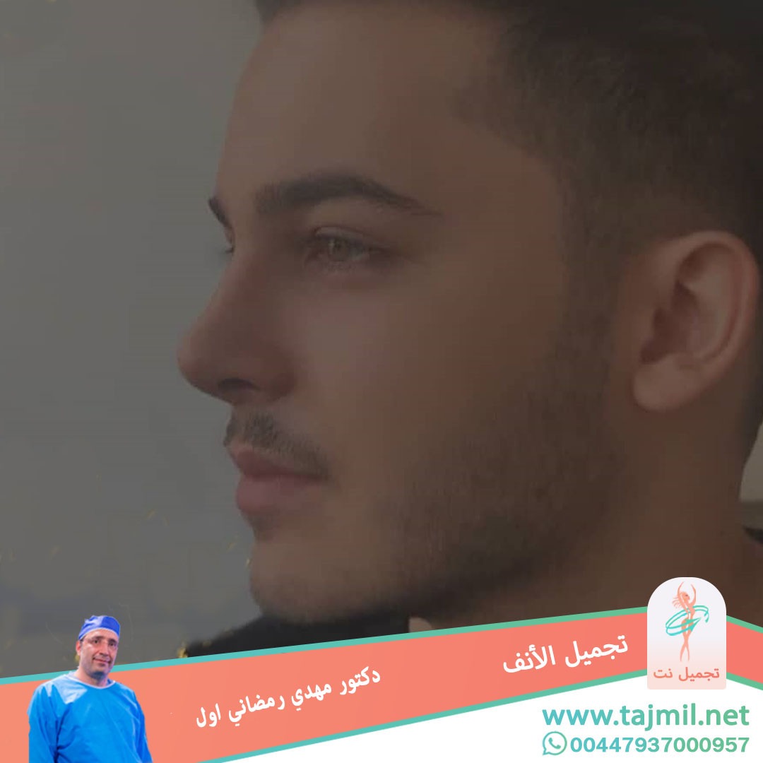  - دكتور مهدي رمضاني اول عملية تجميل الانف في ايران مع تجميل نت