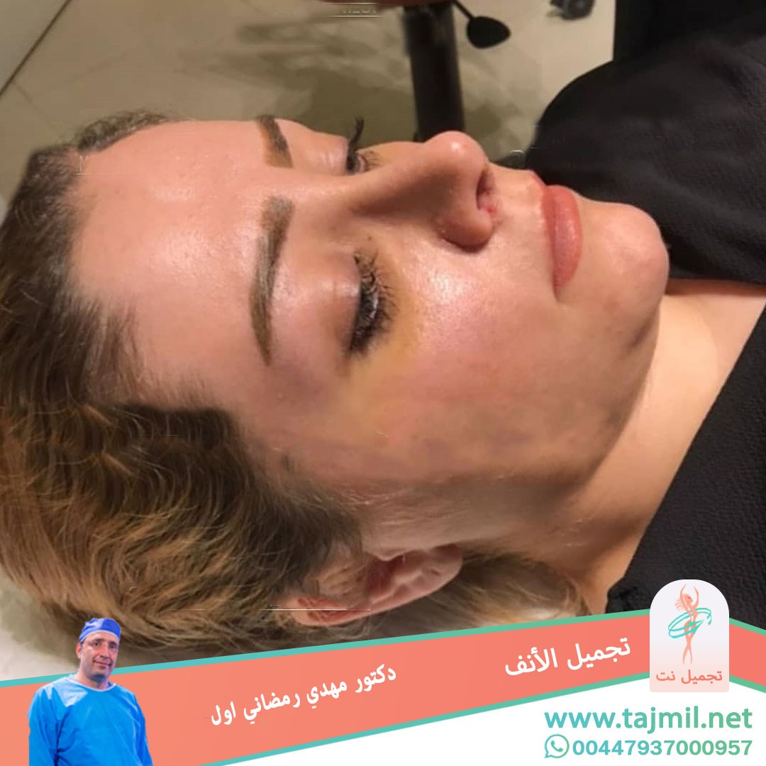  - دكتور مهدي رمضاني اول عملية تجميل الانف في ايران مع تجميل نت