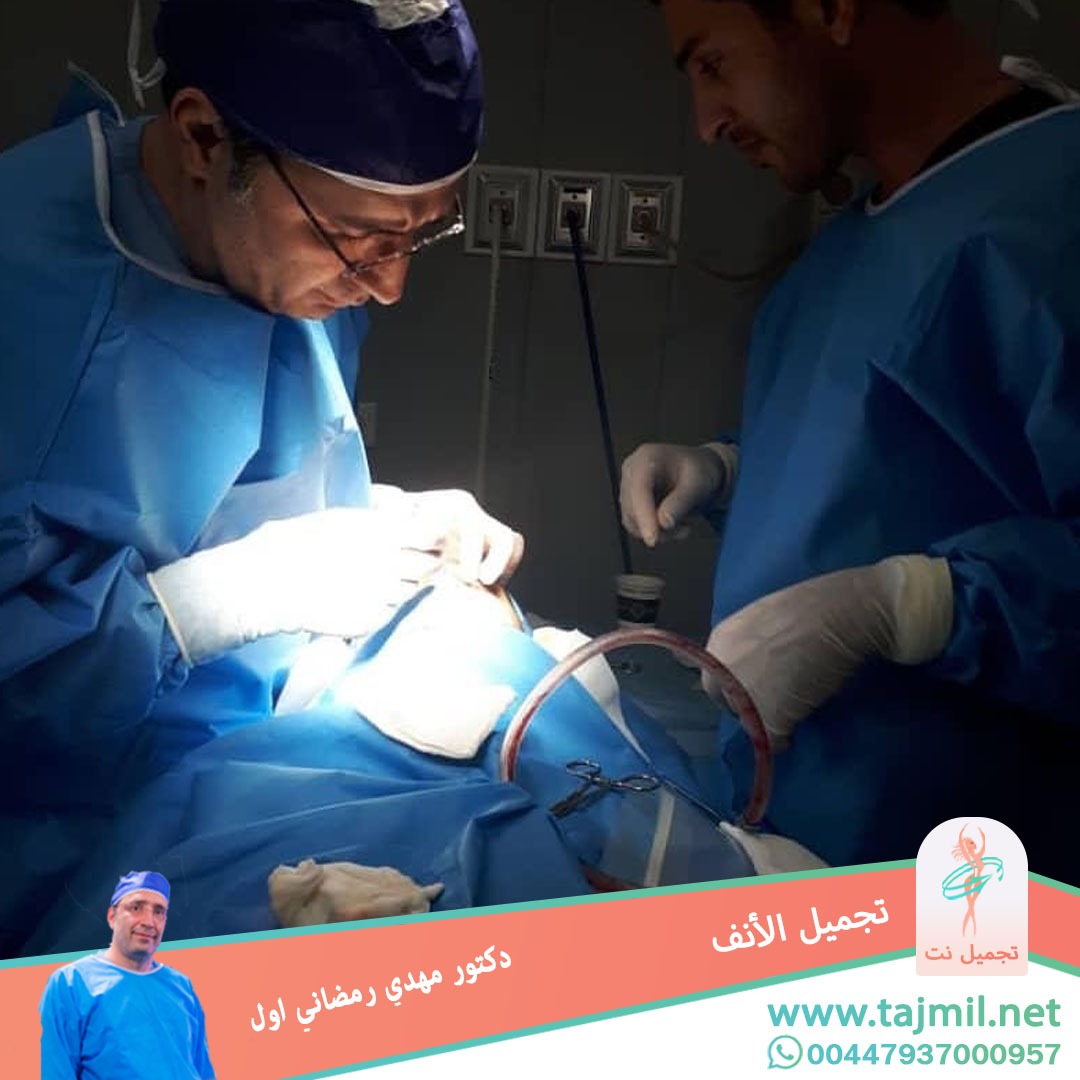  - دكتور مهدي رمضاني اول عملية تجميل الانف في ايران مع تجميل نت