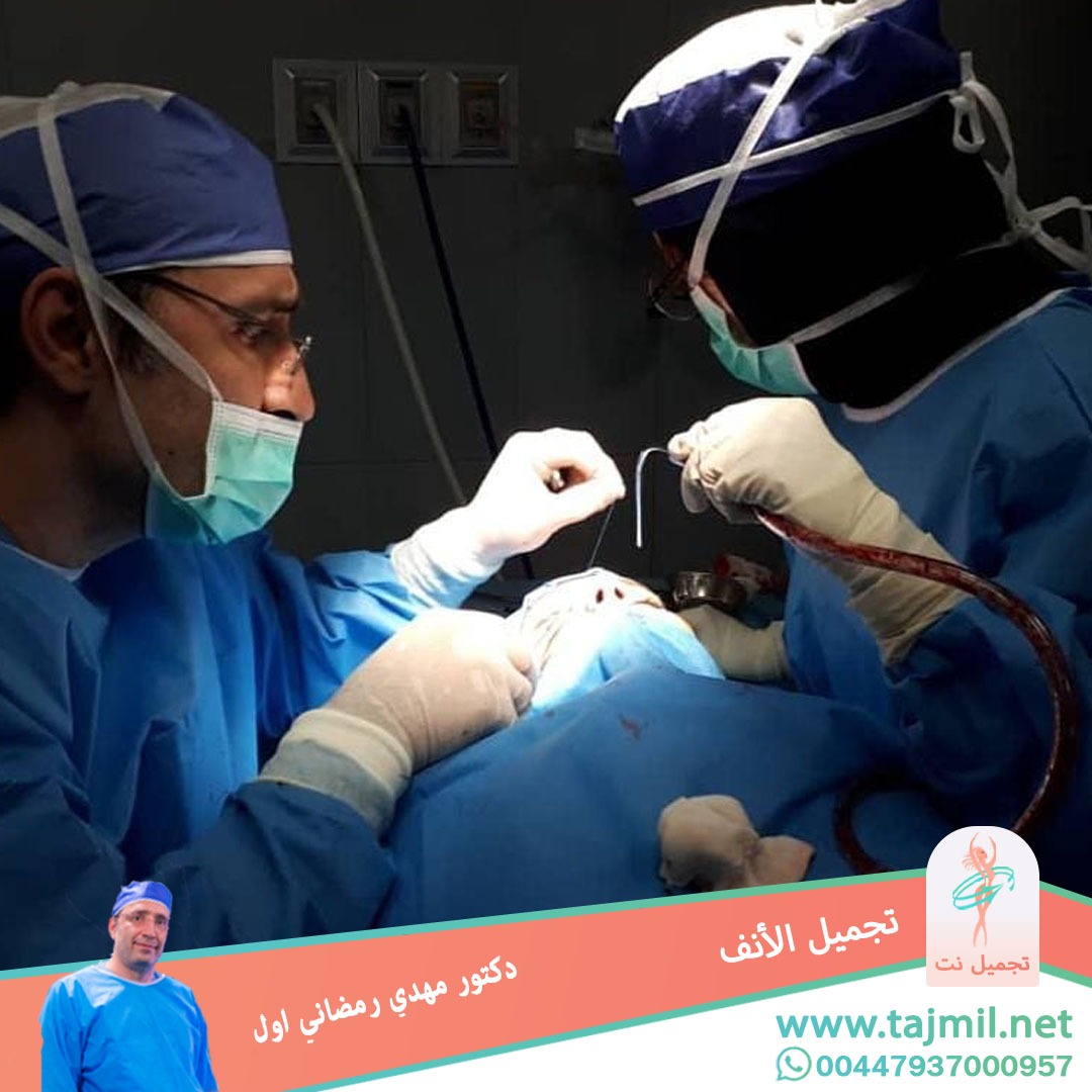  - دكتور مهدي رمضاني اول عملية تجميل الانف في ايران مع تجميل نت