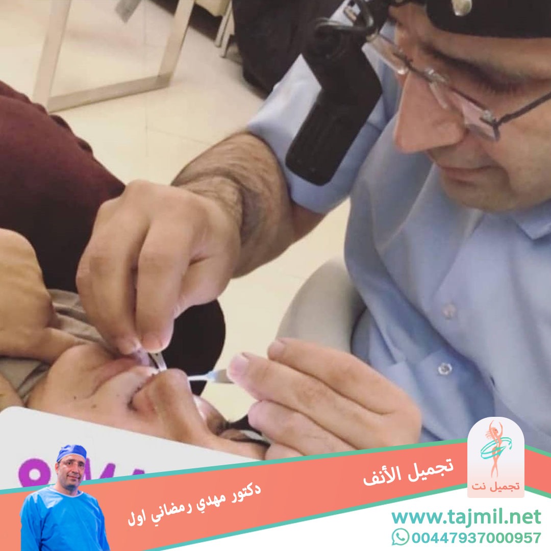  - دكتور مهدي رمضاني اول عملية تجميل الانف في ايران مع تجميل نت