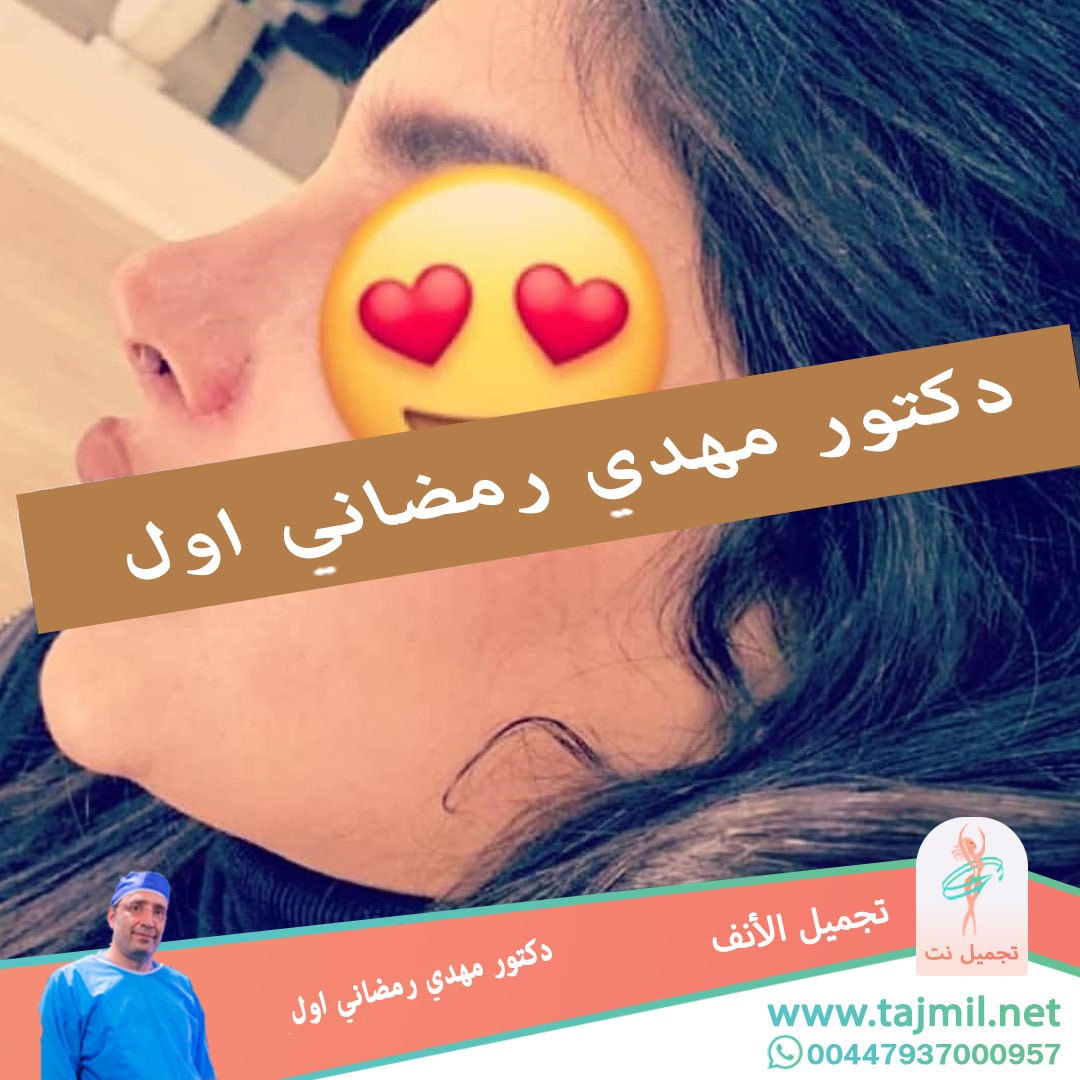  - دكتور مهدي رمضاني اول عملية تجميل الانف في ايران مع تجميل نت