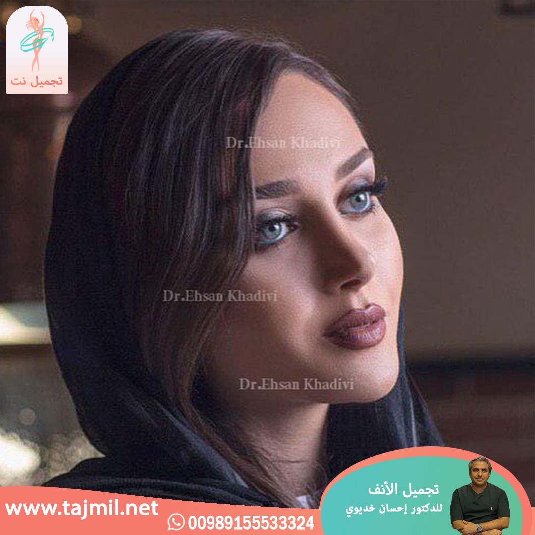  - دکتور إحسان خدیوي عملية تجميل الانف في ايران مع تجميل نت