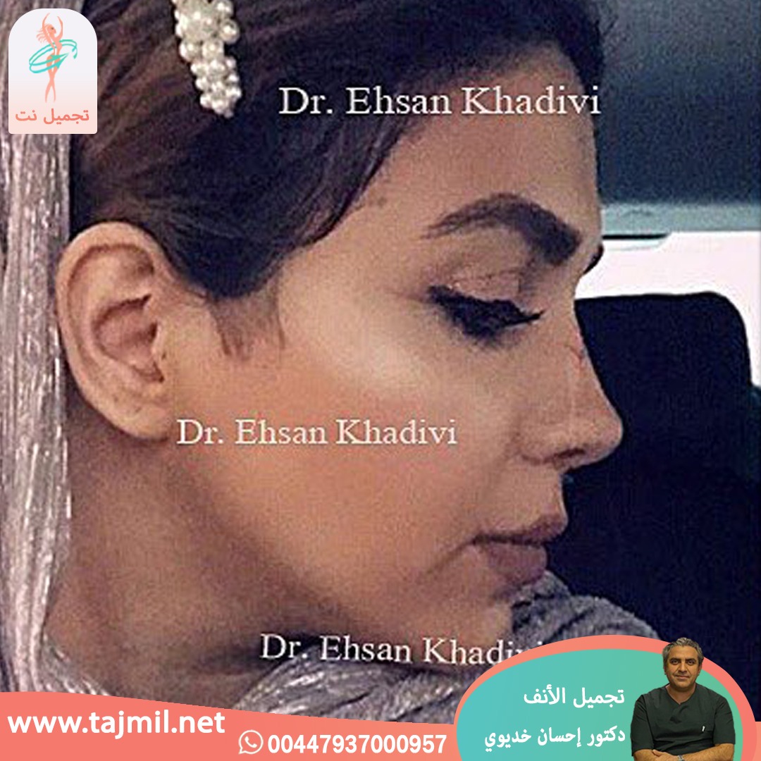  - دکتور إحسان خدیوي عملية تجميل الانف في ايران مع تجميل نت