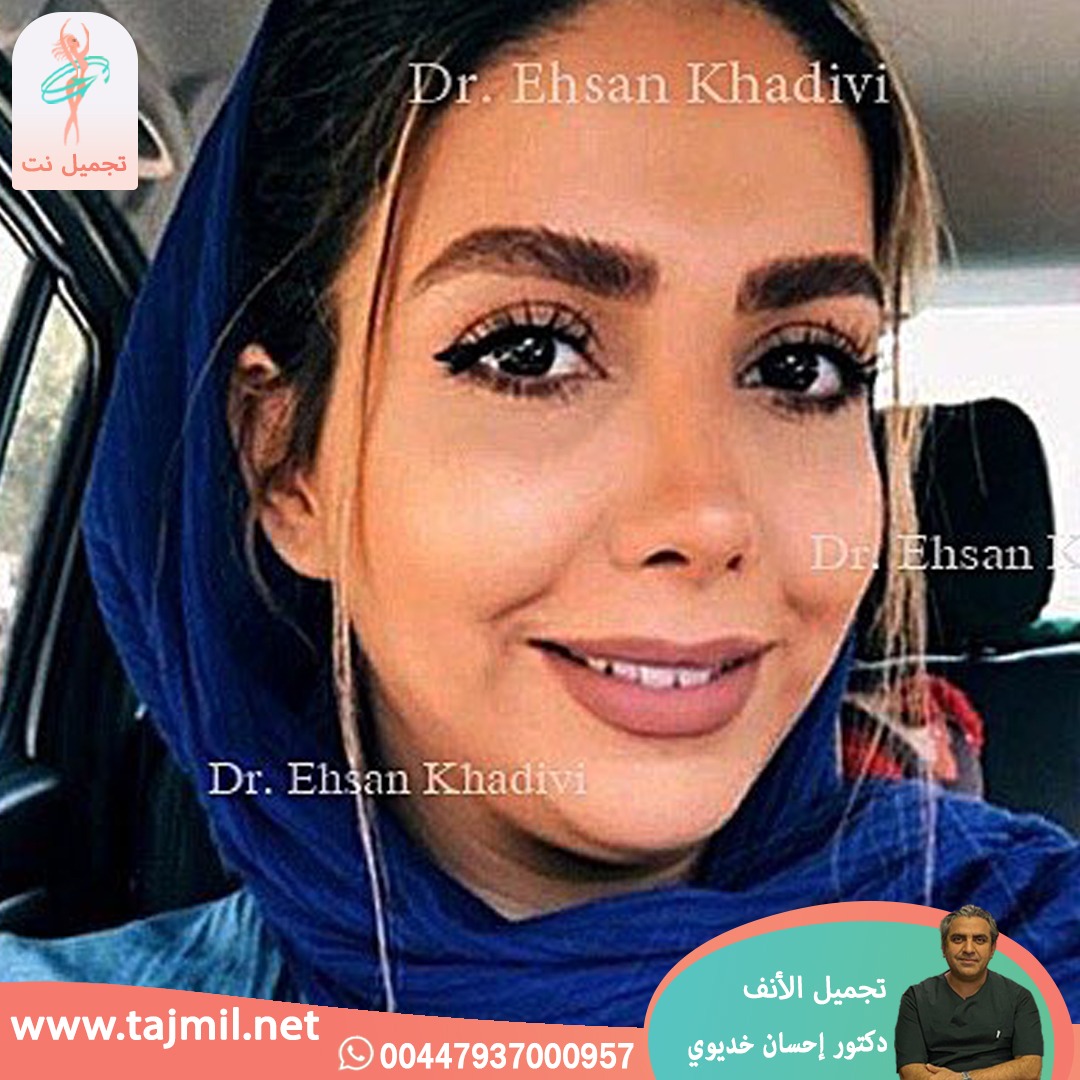  - دکتور إحسان خدیوي عملية تجميل الانف في ايران مع تجميل نت