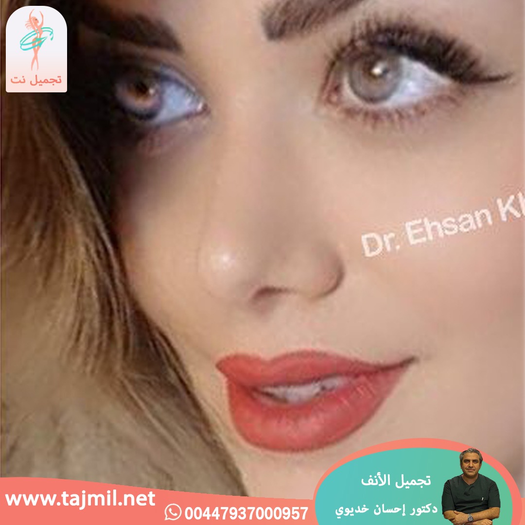  - دکتور إحسان خدیوي عملية تجميل الانف في ايران مع تجميل نت