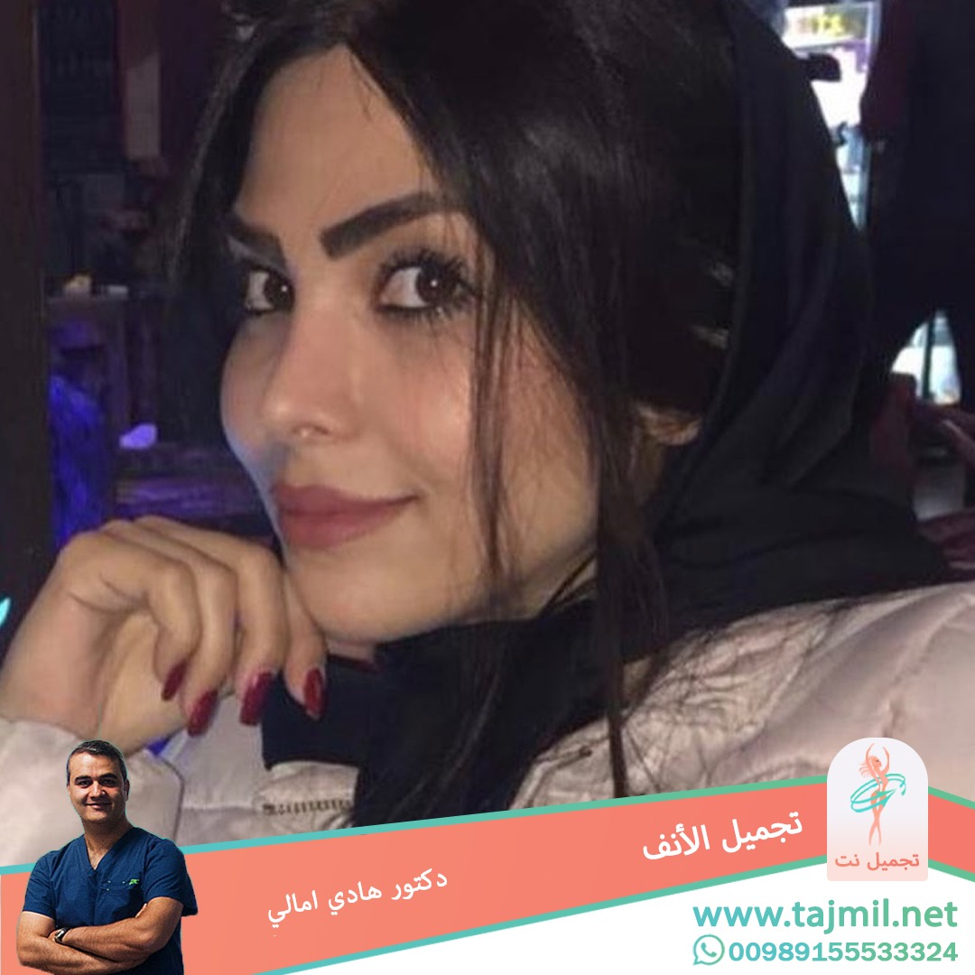  - دکتور هادي امالي عملية تجميل الأنف في ايران مع تجميل نت