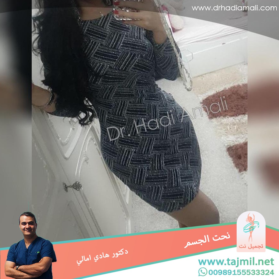  - دکتور هادي امالي عملية نحت الجسم في ايران مع تجميل نت