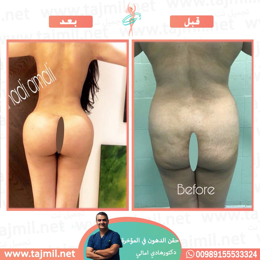  -  المؤخرة  في ايران مع تجميل نت